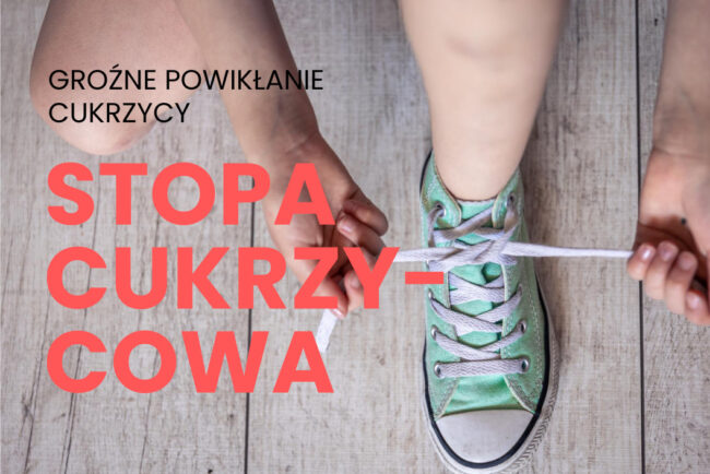 Stopa cukrzycowa groźne powikłanie przy cukrzycy