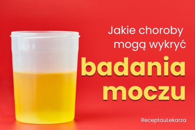 Badania moczu - jakie problemy mogą wykazać?