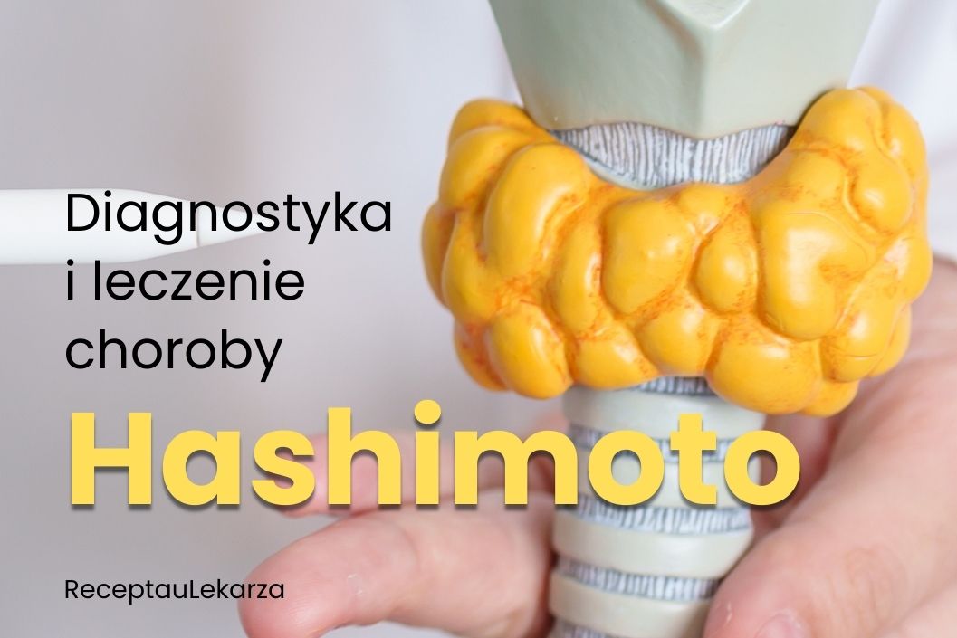 Choroba Hashimoto - diagnostyka i leczenie