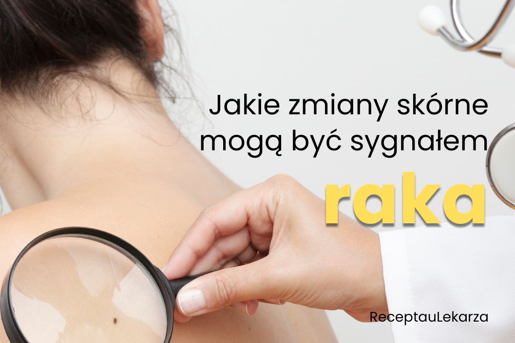 Zmiany skórne - które mogą wskazywać na raka?